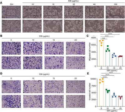 Corrigendum: Induction of RIPK3/MLKL-mediated necroptosis by Erigeron breviscapus injection exhibits potent antitumor effect